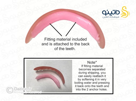 عکس روکش دندان سفید ردیف بالا 14564 - انواع مدل روکش دندان سفید ردیف بالا 14564