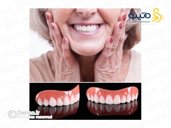 عکس روکش دندان سفید ردیف بالا 14564 - انواع مدل روکش دندان سفید ردیف بالا 14564