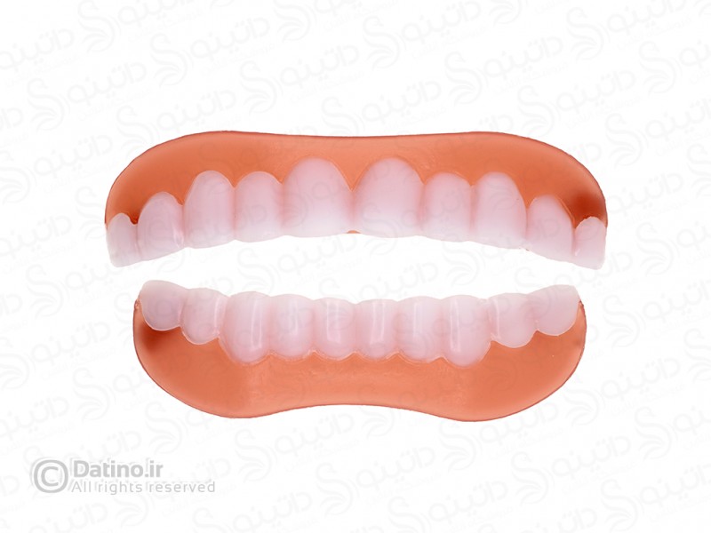 عکس روکش دندان طرح لبخند 19883 - انواع مدل روکش دندان طرح لبخند 19883