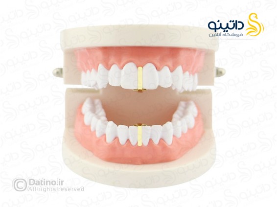 عکس روکش دندان طرح هیپ هاپ کلاسیک 20587 - انواع مدل روکش دندان طرح هیپ هاپ کلاسیک 20587