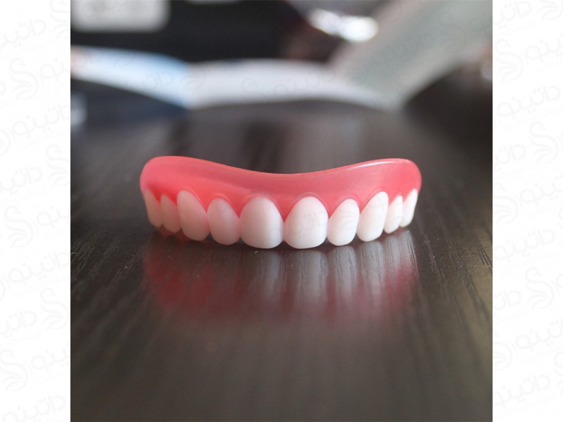 عکس روکش دندان سفید ردیف بالا 14564 - انواع مدل روکش دندان سفید ردیف بالا 14564